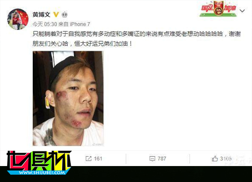 黃博文笑對賽季報銷 隊友：加油兄弟趕上世俱杯-第1張圖片-世俱杯