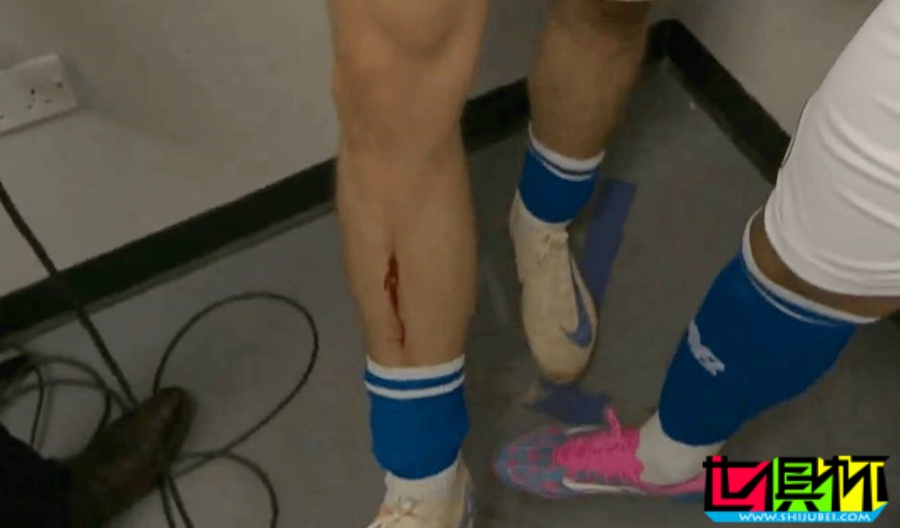 英冠 威爾士德比 發生事故，廣告牌破裂致 卡迪夫城 邊鋒腿部劃傷-第2張圖片-世俱杯